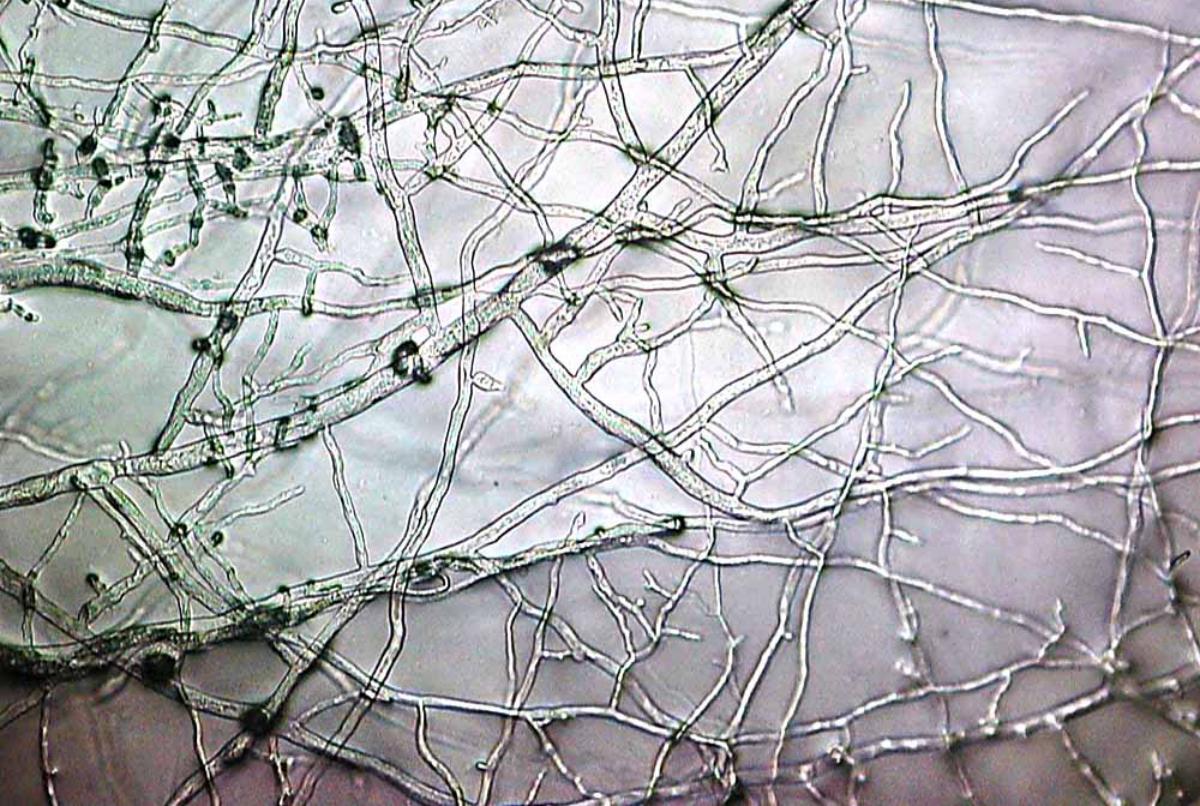 Mycelium sett fra mikroskopet