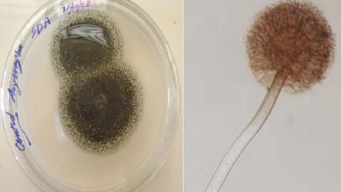 aspergillus niger under mikroskopet